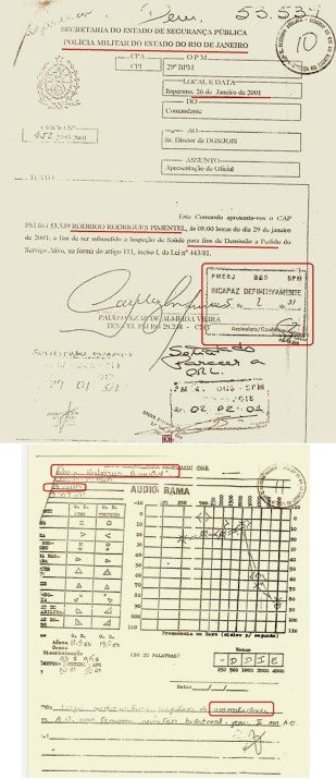 20120212_pimentelaudiometria